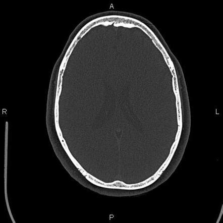 megaeuter|Radiopaedia.org, the peer